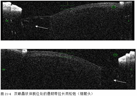 ZY016_107_5.gif